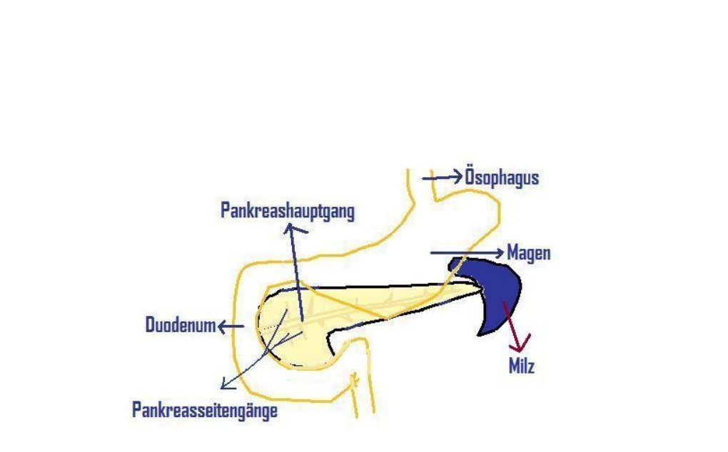 PankreasPankreas ist ein Drüsenargan an der hinteren Bauchwand querliegend zwischen Magen und dahinter verlaufenden Bauchgefäßen in Höhe des 2. Lendenwirbelkörpers. Der Pankreaskopf liegt im Bogen des Zwölffingerdarms wo Ductus pankreaticus mit Duct. Choledochus münden , Mit dem Schwanz erreicht Pankreas den Milz, Die untere Hohlvene liegt direkt hinter dem Corpus des Pankreas, Pankreasoberfläche ist mit Bauchfell überzogenLänge: ca. 15-20 cm Gewicht: ca. 60-80 Gramm Pankreasgewebe besteht aus mehreren kleinen unterscheidlich großen Läppchen.Zwischen Kopf und Körper des Pankreas hinten ist die Pankreaseinkerbung (Incisura pancreatis), wo A.…