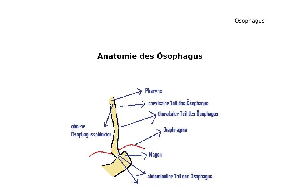 Anatomie des ÖsophagusDer Ösophagus (Speiseröre) ist ein ca. 23-25 cm langes Hohlorgan, der zwischen Hypopharnx und Magen sowie zwischen der Trachea und der Wirbelsäule liegt, mit einer Breite von 2-3cm. Er fördert die Nahrung durch wellenartige Bewegungen der Längstmuskulatur vom Rachen in den Magen. Der Ösophagus hat 3 Teile-) Pars cervicalis (zervikaler Teil des Ösophagus) -) Pars thoracica (thorakaler Teil des Ösophagus) -) Pars abdominalis (abdominaler Teil des Ösophagus)Der Ösophagus hat einen oberen und einen unteren Ösophagussphincter (Upper and lower oesophageal sphincter)…